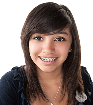 Orthodontic Services